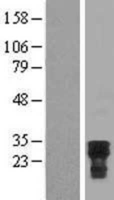 Western Blot: CDC42EP2 Overexpression Lysate [NBL1-09008]