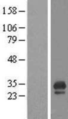 Western Blot: CDC42EP3 Overexpression Lysate [NBL1-09009]