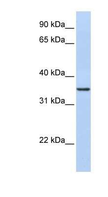 Western Blot: CDC42EP4 Antibody [NBP1-53150]