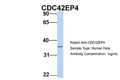 Western Blot: CDC42EP4 Antibody [NBP1-53150]