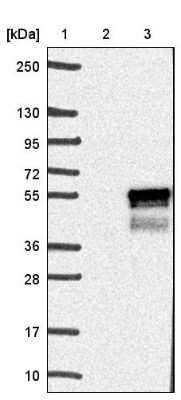 Western Blot: CDC42EP4 Antibody [NBP1-88381]