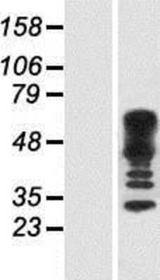 Western Blot: CDC42EP4 Overexpression Lysate [NBP2-07490]