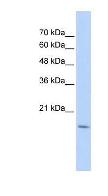 Western Blot: CDC42EP5 Antibody [NBP1-70491]