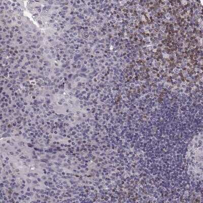 Immunohistochemistry-Paraffin: CDC42SE1 Antibody [NBP1-80780]