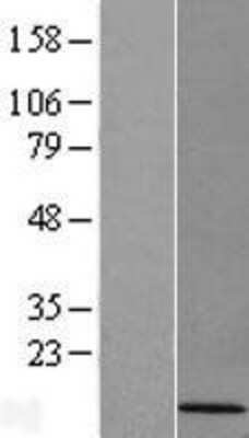 Western Blot: CDC42SE1 Overexpression Lysate [NBL1-09011]