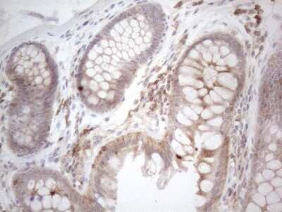Immunohistochemistry: CDC42SE2 Antibody (OTI1B12) [NBP2-46191]