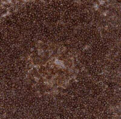 Immunohistochemistry-Paraffin: CDC42SE2 Antibody [NBP1-82131]