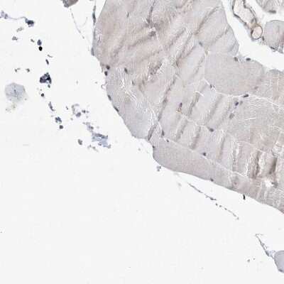 Immunohistochemistry-Paraffin: CDC42SE2 Antibody [NBP1-82131]