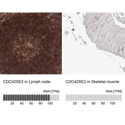 Immunohistochemistry-Paraffin: CDC42SE2 Antibody [NBP1-82131]