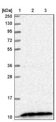 Western Blot: CDC42SE2 Antibody [NBP1-82131]