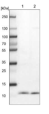 Western Blot: CDC42SE2 Antibody [NBP1-82131]