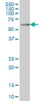 Western Blot: CDC45L Antibody (4C2) [H00008318-M02]