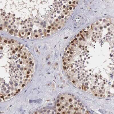 Immunohistochemistry-Paraffin: CDC45L Antibody [NBP1-85723]