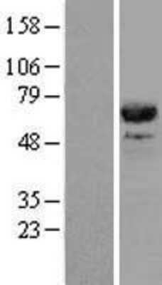 Western Blot: CDC45L Overexpression Lysate [NBL1-09012]