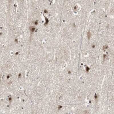 Immunohistochemistry-Paraffin: CDC5L Antibody [NBP1-85719]