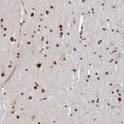 Immunohistochemistry-Paraffin: CDC5L Antibody [NBP1-85720]