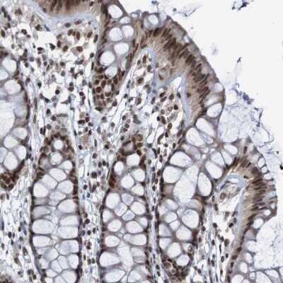 Immunohistochemistry-Paraffin: CDC5L Antibody [NBP1-85720]