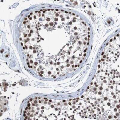 Immunohistochemistry-Paraffin: CDC5L Antibody [NBP1-85720]