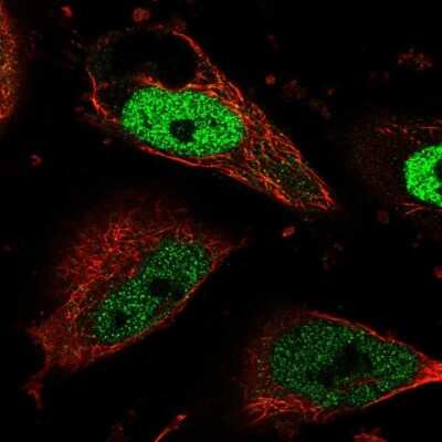 Immunocytochemistry/ Immunofluorescence: CDC7 Antibody [NBP2-32708]