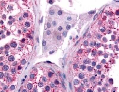 Immunohistochemistry-Paraffin: CDC7 Antibody - BSA Free [NLS7979]