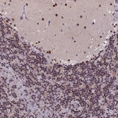 Immunohistochemistry-Paraffin: CDC7 Antibody [NBP2-32708]