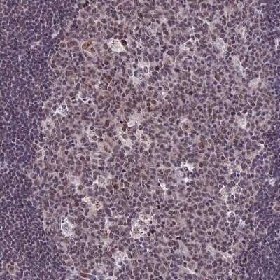 Immunohistochemistry-Paraffin: CDC7 Antibody [NBP2-32708]