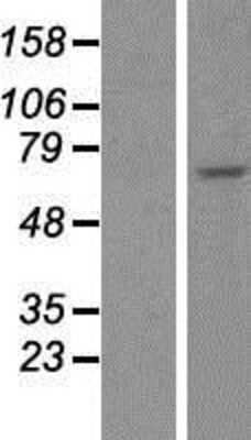 Western Blot: CDC7 Overexpression Lysate [NBP2-07998]