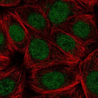 Immunocytochemistry/ Immunofluorescence: CDC73/HRPT2 Antibody [NBP2-55257]