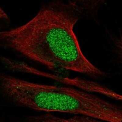 Immunocytochemistry/ Immunofluorescence: CDC73/HRPT2 Antibody [NBP3-17817]