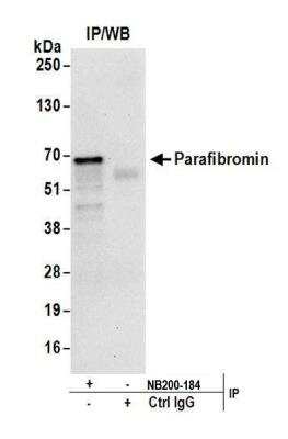 Immunoprecipitation: CDC73/HRPT2 Antibody [NB200-184]