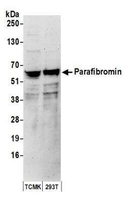 Western Blot: CDC73/HRPT2 Antibody [NB200-184]