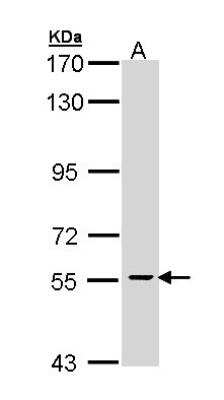 Western Blot: CDC73/HRPT2 Antibody [NBP1-32972]