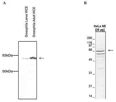 Western Blot: CDC73/HRPT2 Antibody [NBP2-59257]