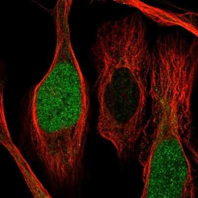 Immunocytochemistry/ Immunofluorescence: CDCA2 Antibody [NBP1-87139]