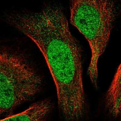 Immunocytochemistry/ Immunofluorescence: CDCA2 Antibody [NBP1-87140]