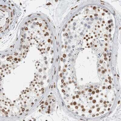 Immunohistochemistry-Paraffin: CDCA2 Antibody [NBP1-87139]