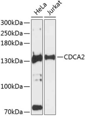 Western Blot: CDCA2 AntibodyAzide and BSA Free [NBP2-92580]