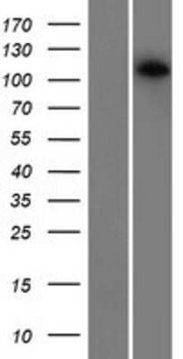 Western Blot: CDCA2 Overexpression Lysate [NBP2-05350]