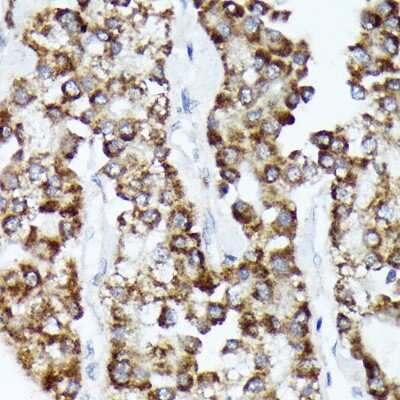Immunohistochemistry-Paraffin: CDCA3 Antibody (1J5L2) [NBP3-16514]