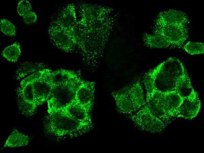 Immunocytochemistry/ Immunofluorescence: CDCA3 Antibody [NBP2-98988]