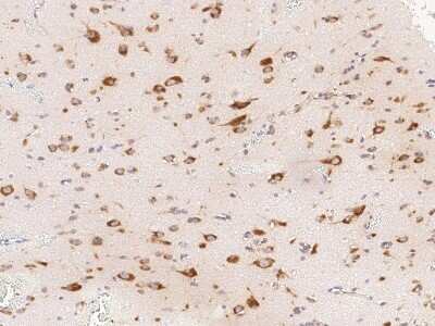 Immunohistochemistry-Paraffin: CDCA3 Antibody [NBP2-98988]