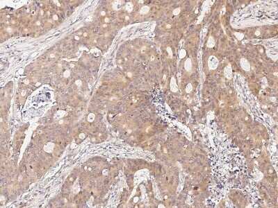 Immunohistochemistry-Paraffin: CDCA3 Antibody [NBP2-98988]