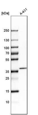 Western Blot: CDCA3 Antibody [NBP1-83332]