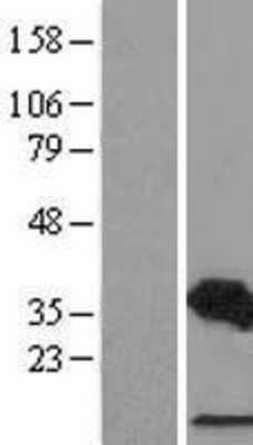 Western Blot: CDCA3 Overexpression Lysate [NBL1-09016]