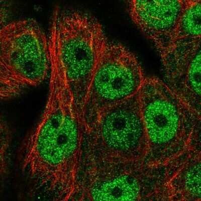 Immunocytochemistry/ Immunofluorescence: CDCA4 Antibody [NBP2-57660]