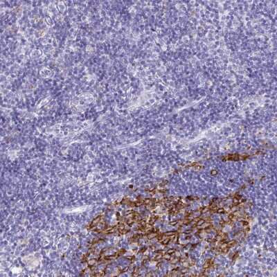 Immunohistochemistry-Paraffin: CDCA4 Antibody [NBP2-32457]