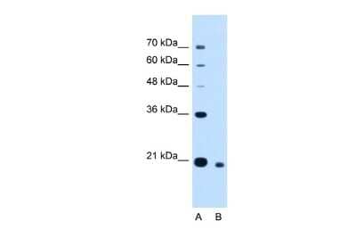 Western Blot: CDCA4 Antibody [NBP2-84641]