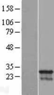 Western Blot: CDCA4 Overexpression Lysate [NBL1-09017]