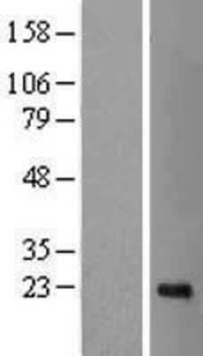 Western Blot: CDCA4 Overexpression Lysate [NBL1-09018]