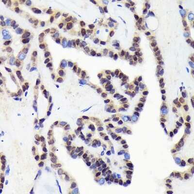 Immunohistochemistry-Paraffin: CDCA5 Antibody (1Y1C9) [NBP3-16318]